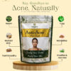 Ani acne new 2